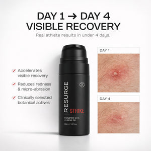 STRIKE gel before and after showing visible skin recovery from day 1 to day 4