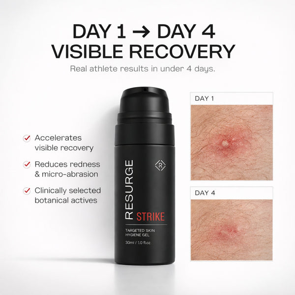 STRIKE gel before and after showing visible skin recovery from day 1 to day 4